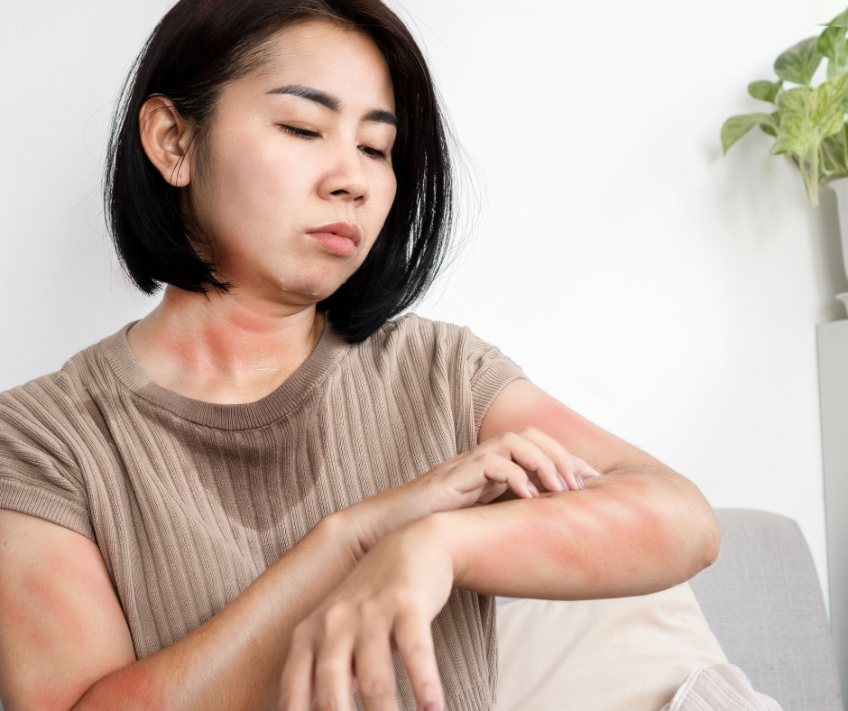 woman with itchy hives