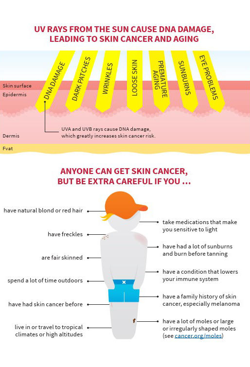 prevent skin cancer_L1